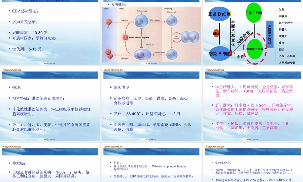 EBV及传染性单核细胞增多症.pptx