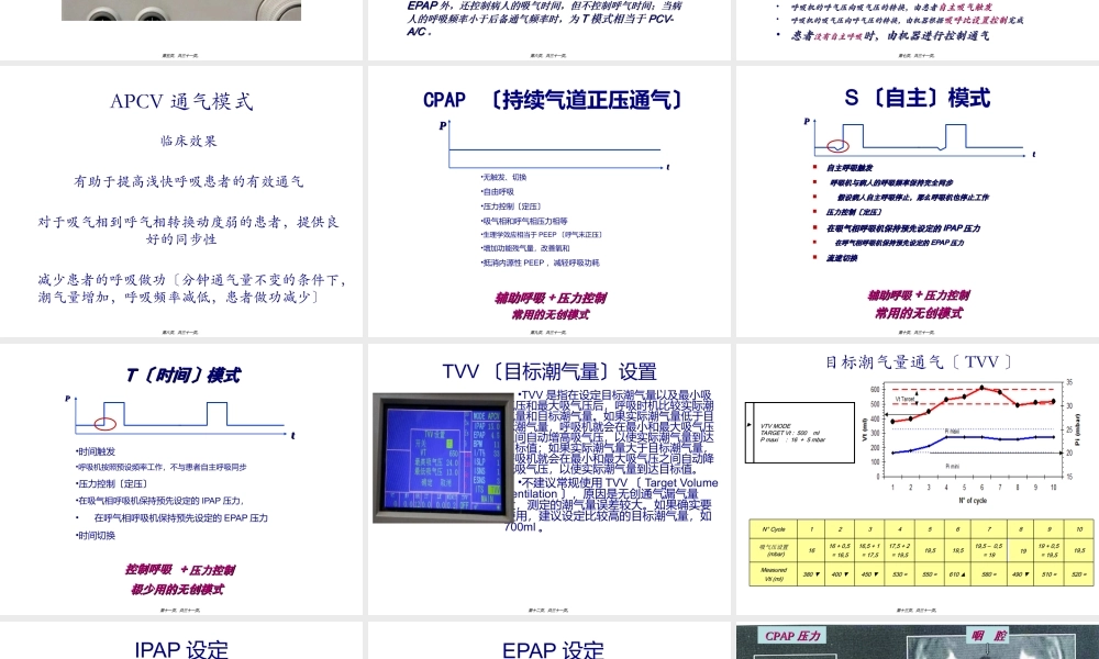 FLEXO无创呼吸机参数调节.ppt