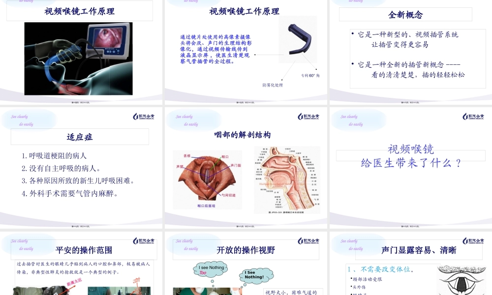 GlideScope视频喉镜介绍.pptx