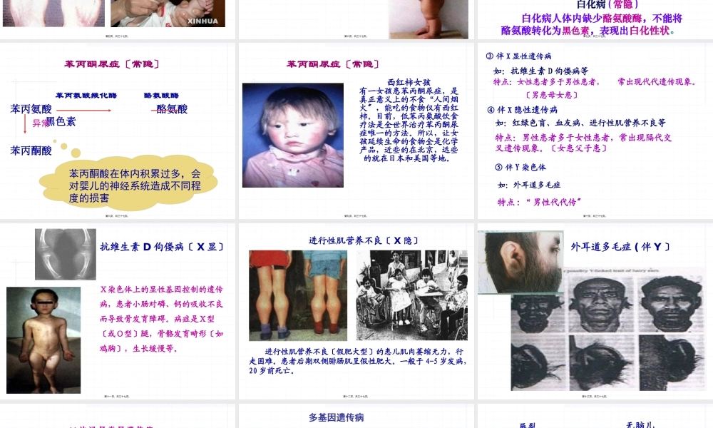 guan人类遗传病.pptx