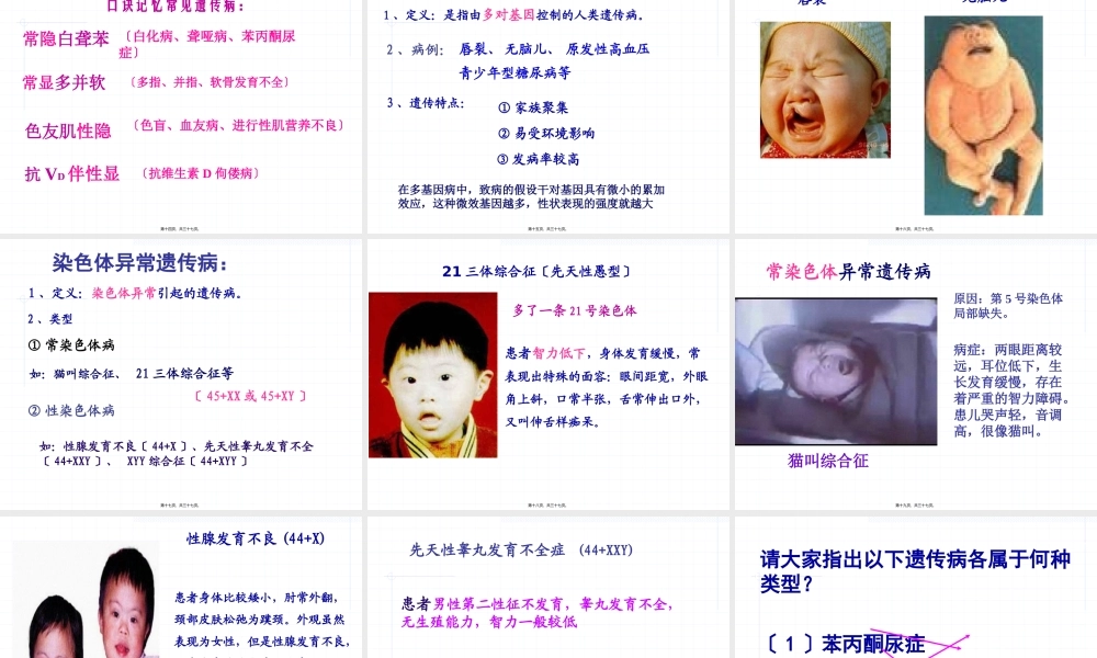 guan人类遗传病.pptx