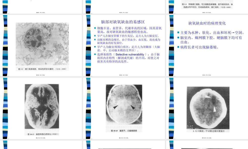 HIE新生儿缺氧缺血性脑病.pptx