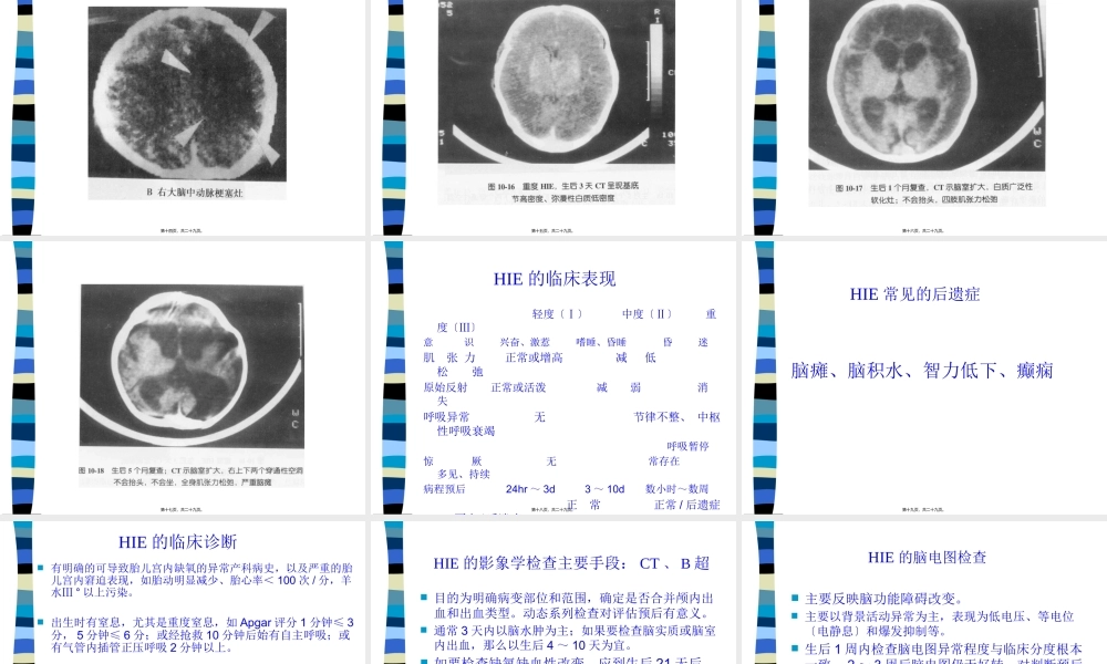 HIE新生儿缺氧缺血性脑病.pptx