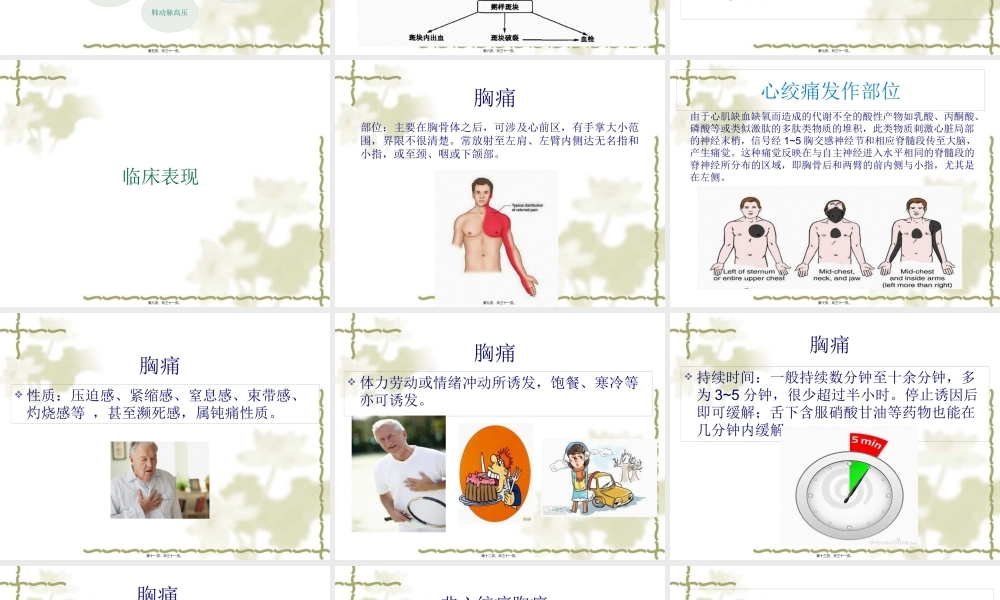 H稳定型心绞痛.pptx