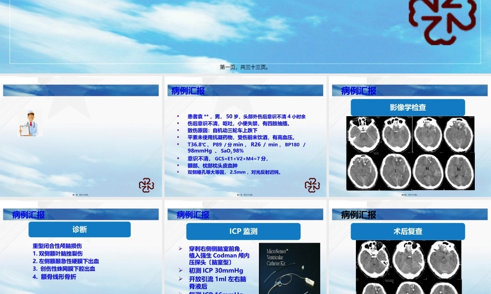 ICP在颅脑创伤中的应用.pptx