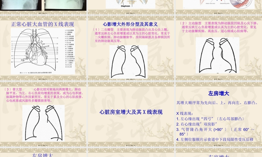 ICU床旁胸片.pptx