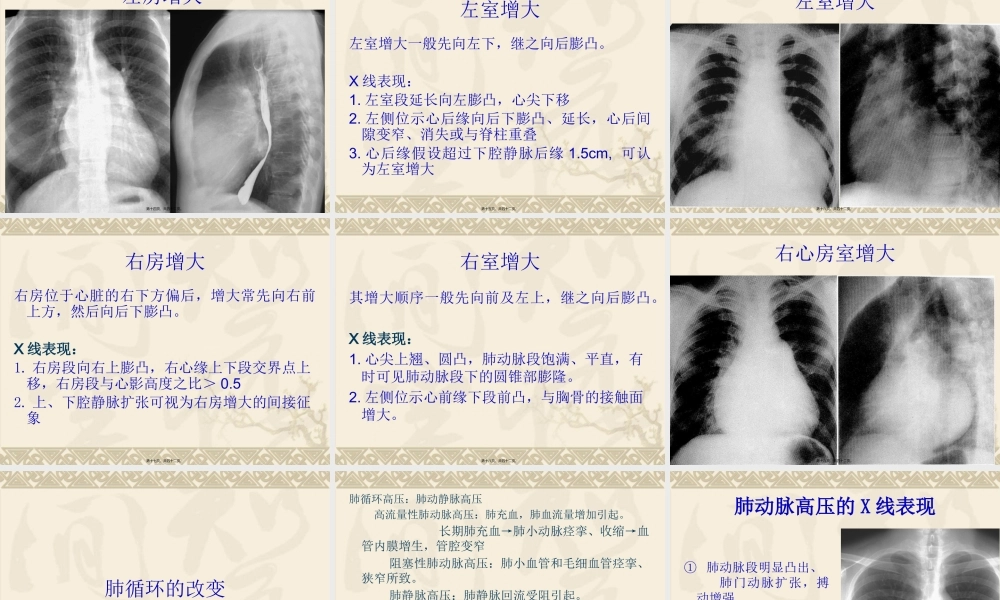 ICU床旁胸片.pptx