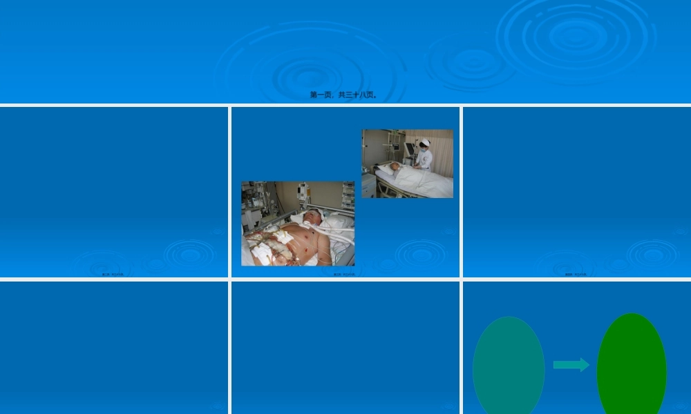 ICU患者的镇静镇痛如何实施.pptx