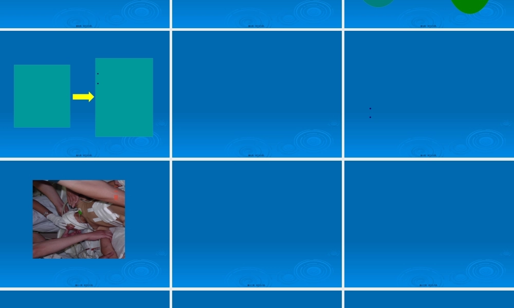 ICU患者的镇静镇痛如何实施.pptx