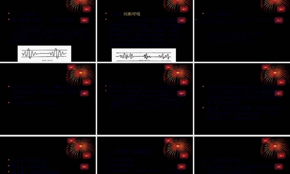 ICU生命体征监测.pptx