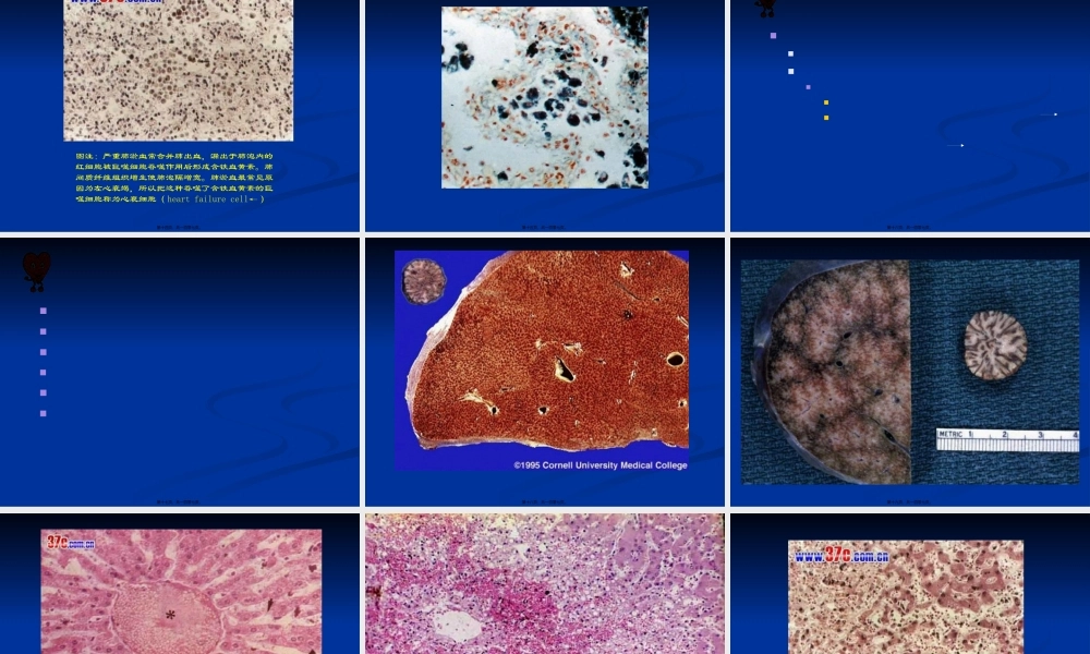 Chapter-3-血液循环障碍.pptx