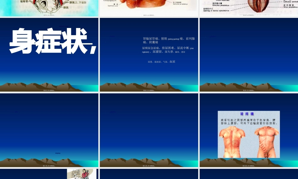 2022年医学专题—泌尿系统检查.ppt