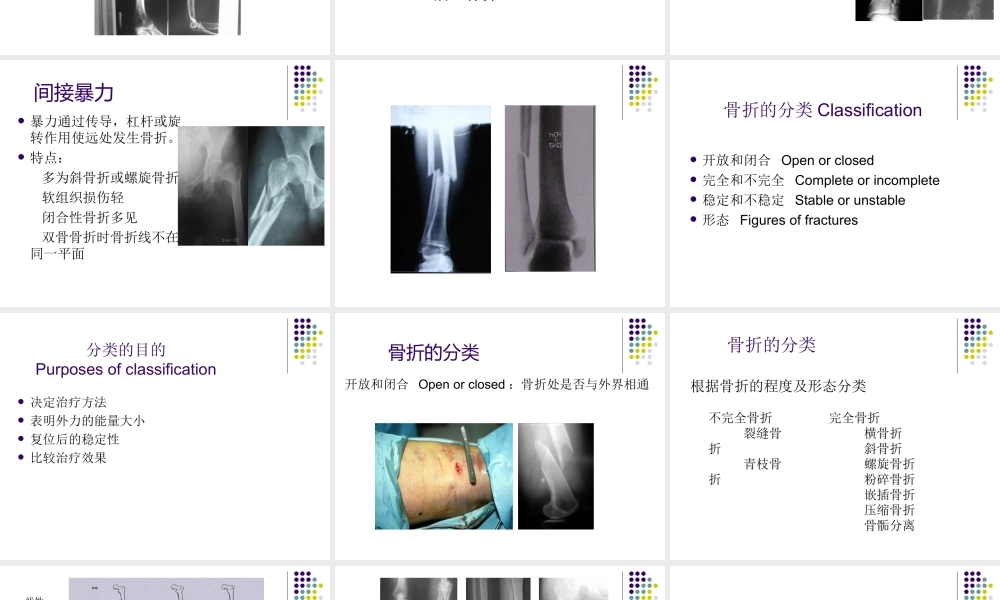22骨科-骨折总论-(1).ppt