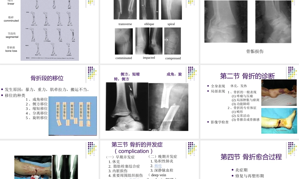 22骨科-骨折总论-(1).ppt