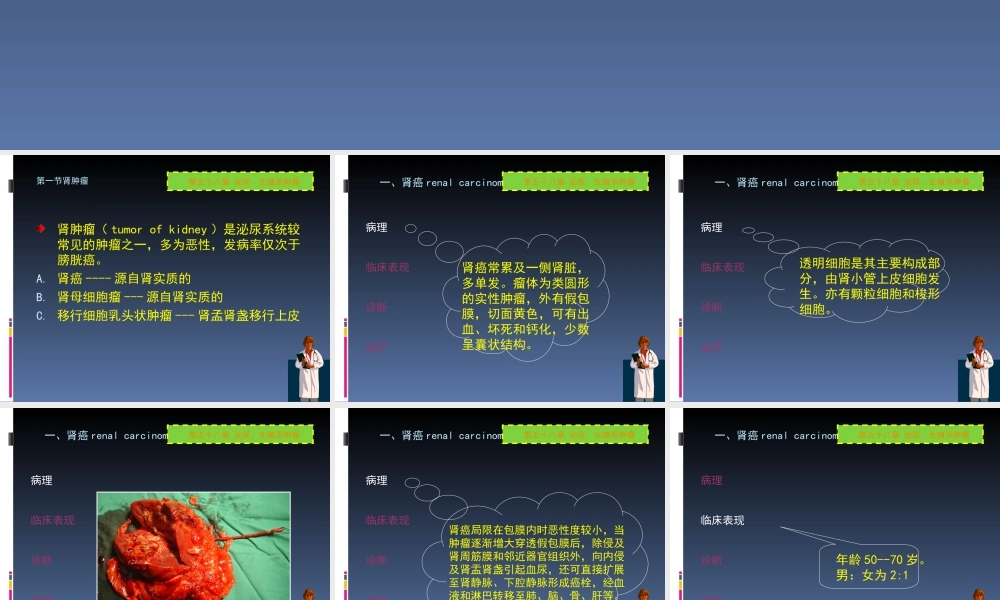 50泌尿科-泌尿系肿瘤(1).ppt