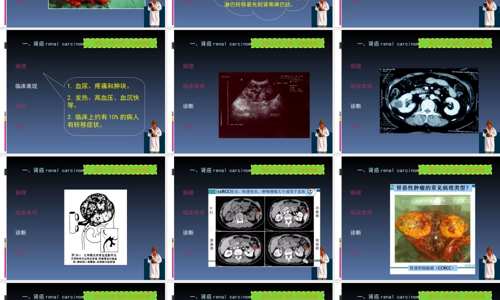 50泌尿科-泌尿系肿瘤(1).ppt