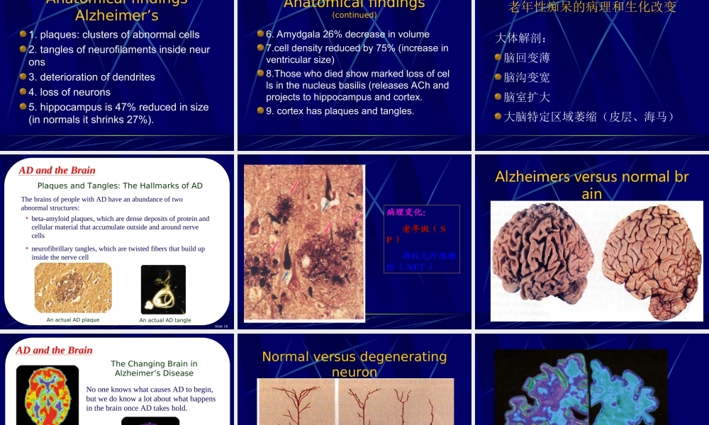 98神经内科-老年痴呆症2(1).ppt