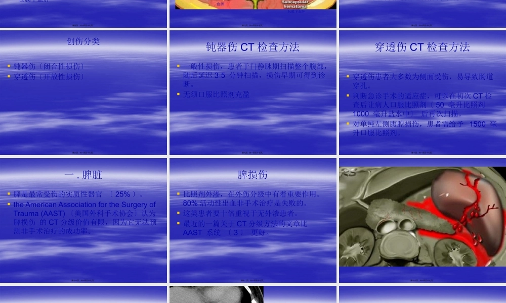 CT在腹部外伤中的应用概述.pptx