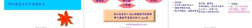 5-肝癌--2013.pptx