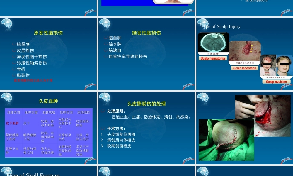 59脑外科-颅脑外伤(1).ppt