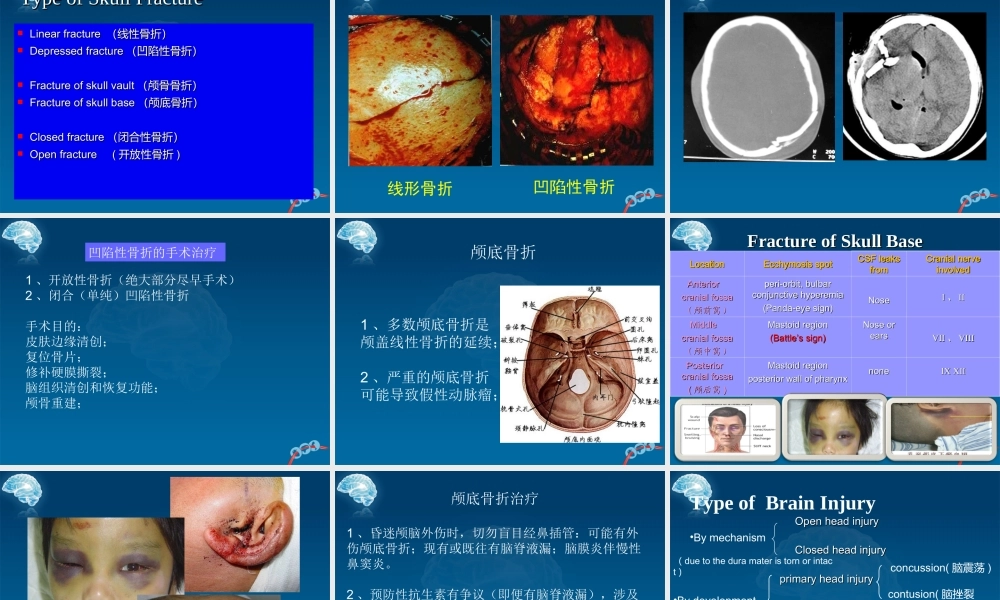 59脑外科-颅脑外伤(1).ppt