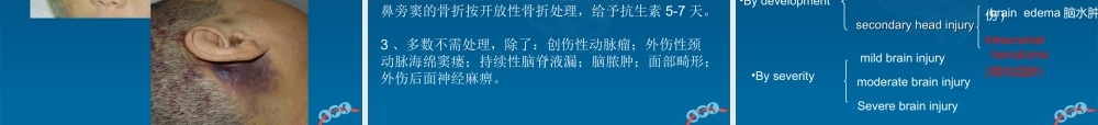 59脑外科-颅脑外伤(1).ppt