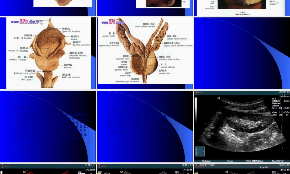 8.泌尿系统及前列腺超声检查.pptx