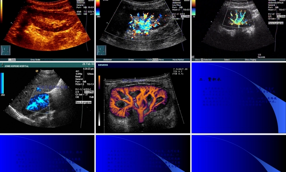 8.泌尿系统及前列腺超声检查.pptx