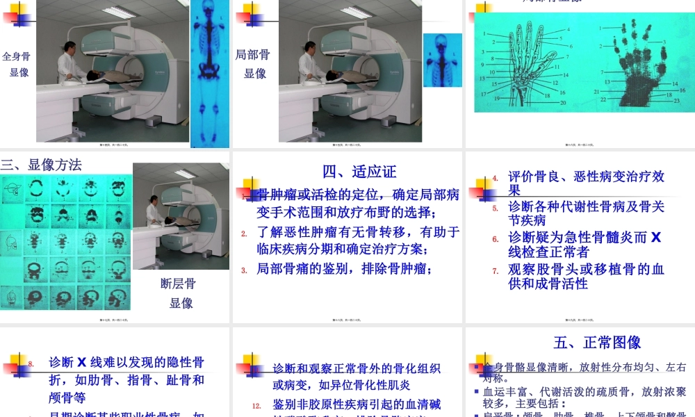 9第十一章骨显像.pptx
