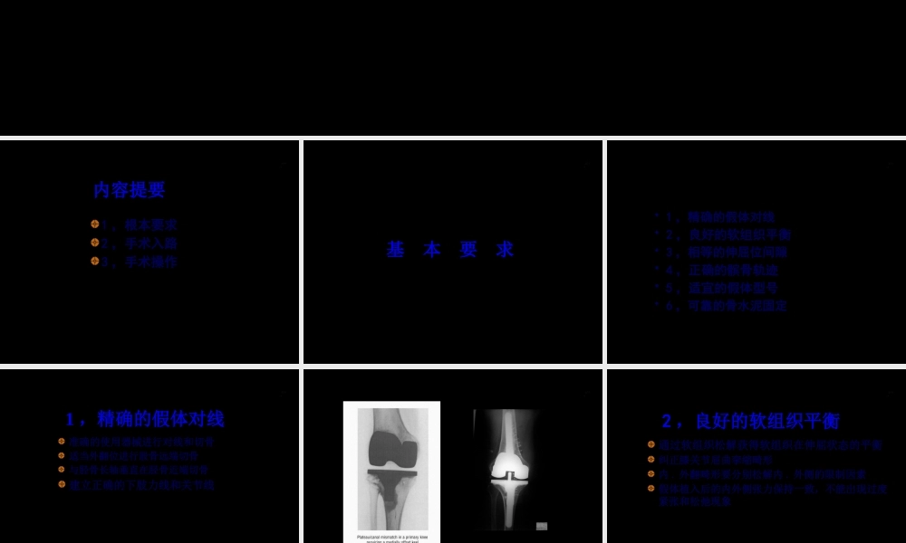 DePuy全膝关节置换手术-0.pptx