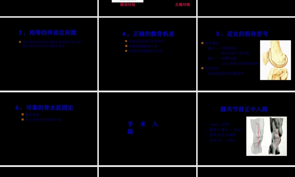 DePuy全膝关节置换手术-0.pptx