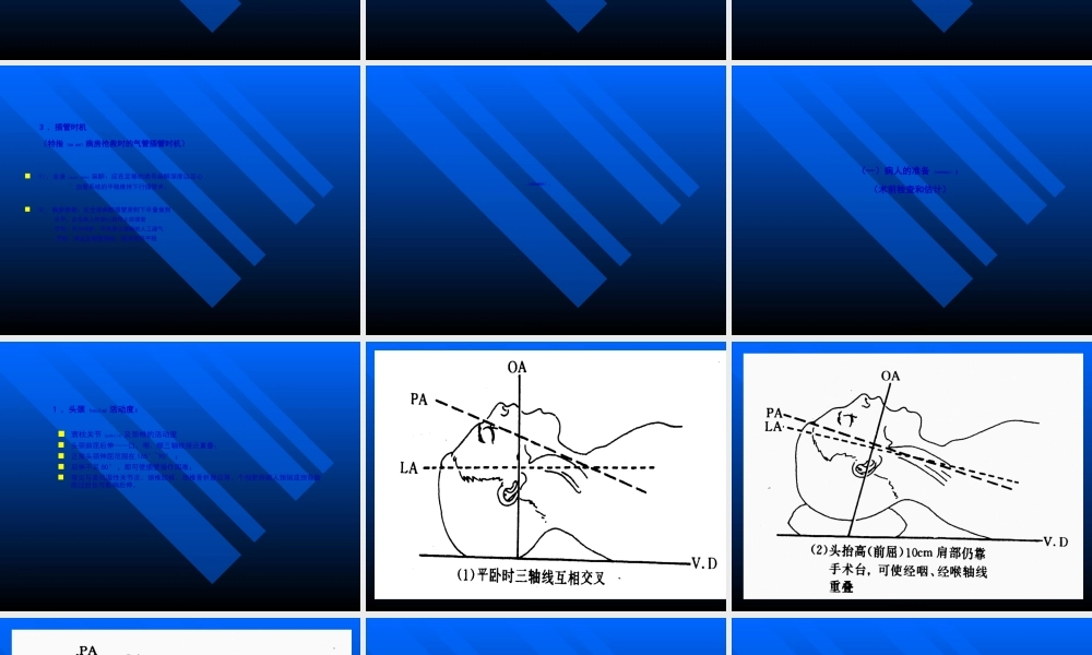 2022年医学专题—气管及支气管内插管术...ppt