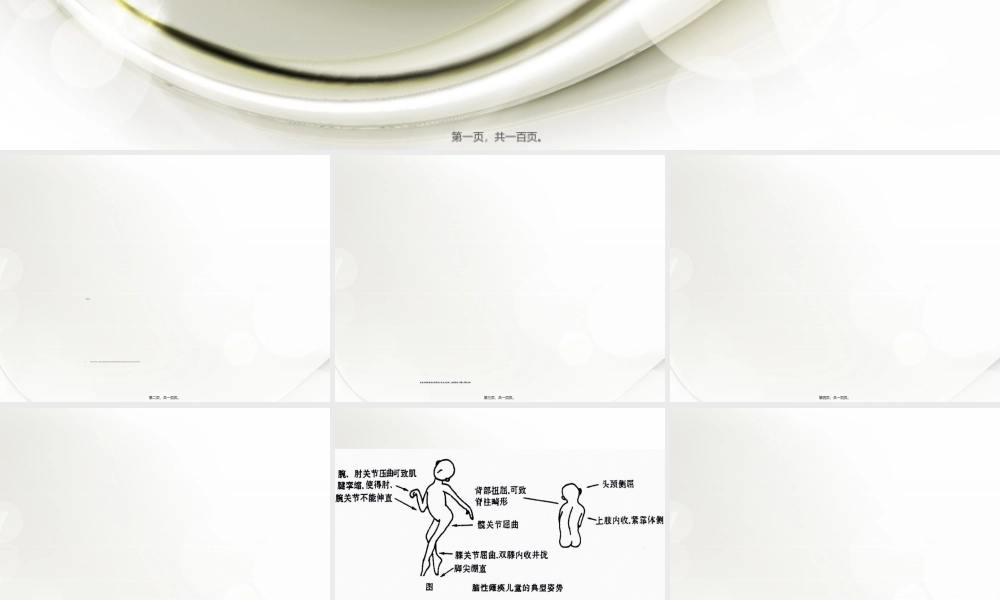 2022年医学专题—脑瘫康复概述.ppt