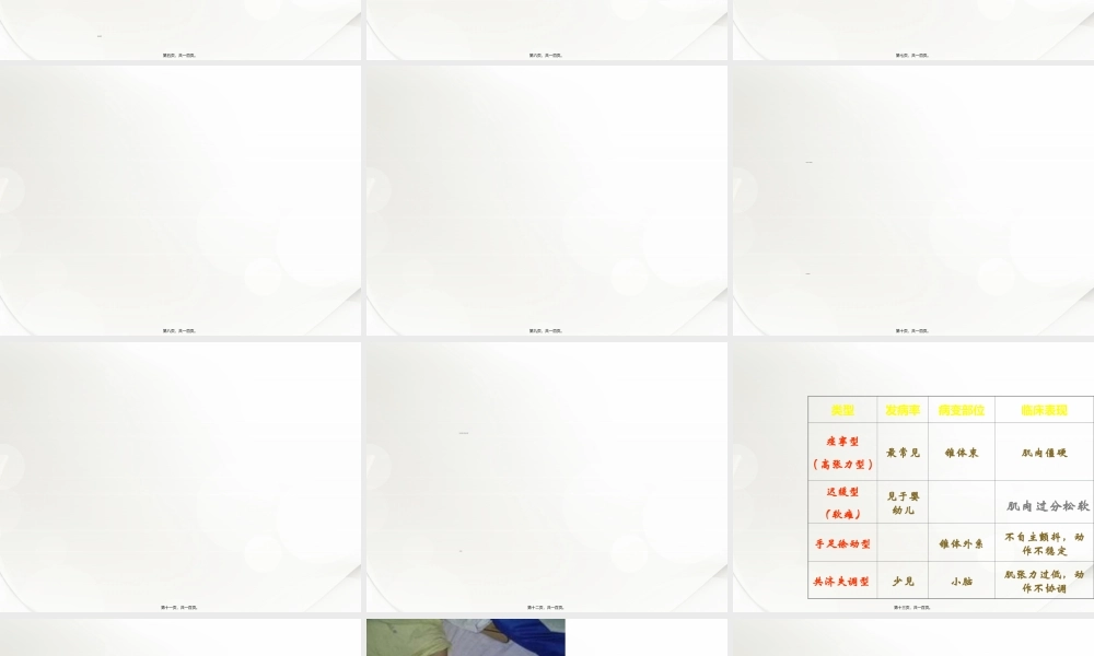 2022年医学专题—脑瘫康复概述.ppt