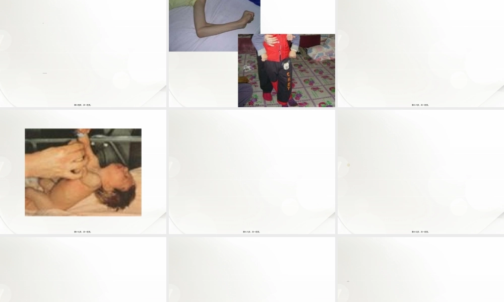 2022年医学专题—脑瘫康复概述.ppt