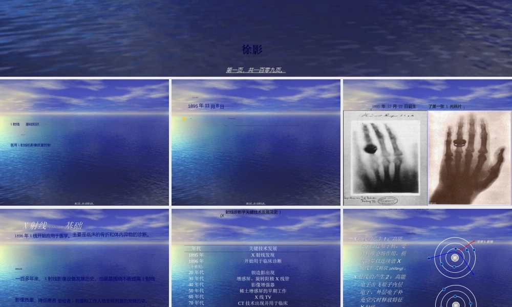 2022年医学专题—医用X射线机的影像质量控制-徐影.ppt