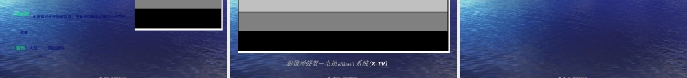 2022年医学专题—医用X射线机的影像质量控制-徐影.ppt