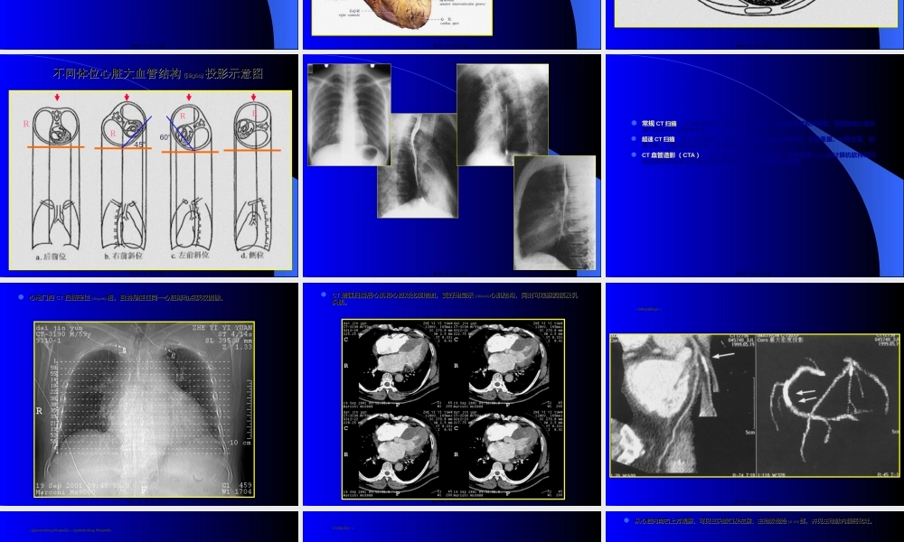 2022年医学专题—心脏与大血管影象.ppt
