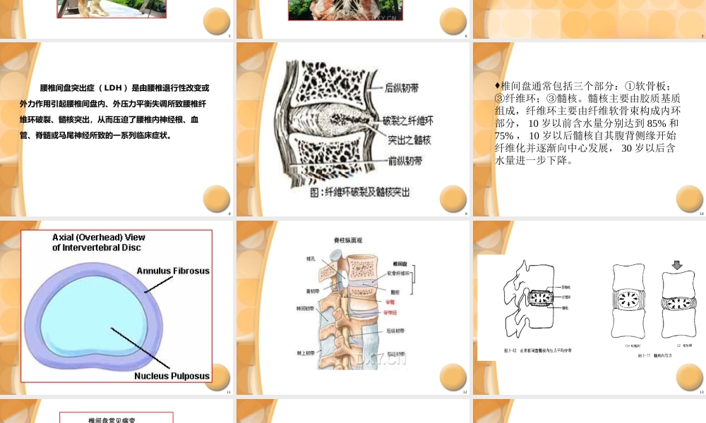 34骨科-腰椎间盘突出症诊治PPT课件(1).ppt