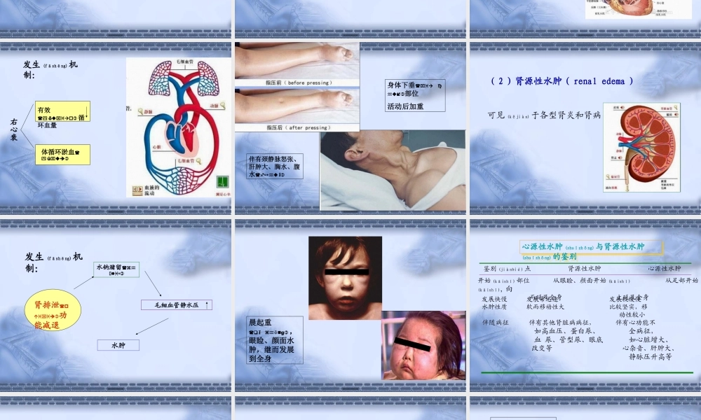 2022年医学专题—发绀胸痛水肿心悸-文档资料.ppt
