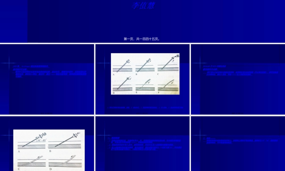 2022年医学专题—支架血管成形术器材-雅安职业技术学院.ppt