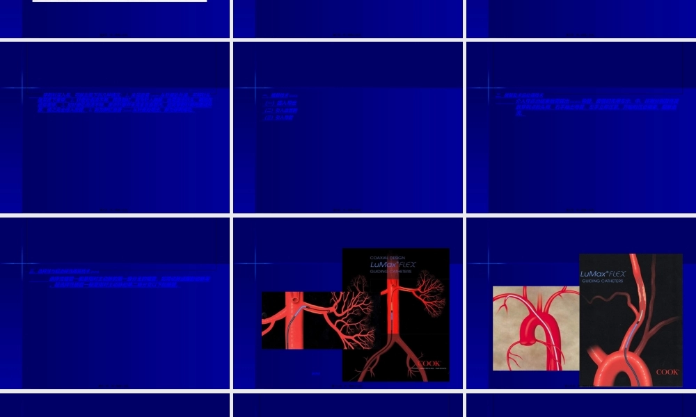 2022年医学专题—支架血管成形术器材-雅安职业技术学院.ppt