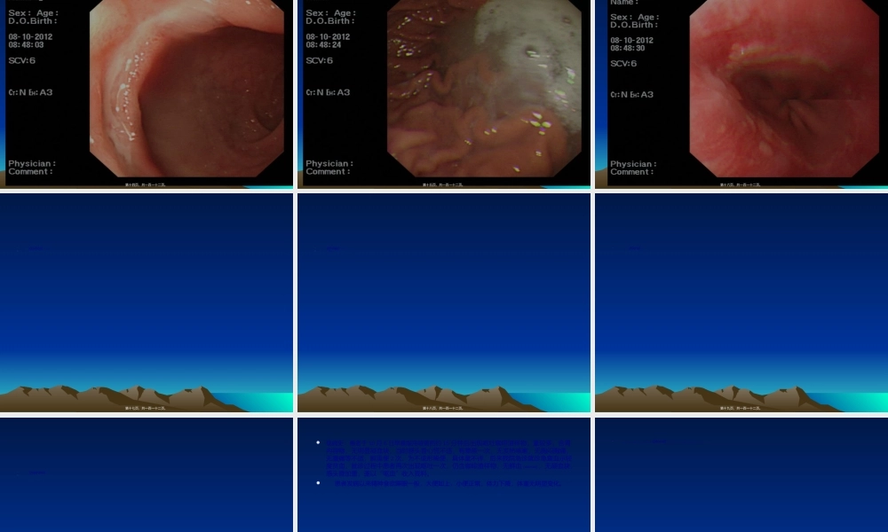 2022年医学专题—病案分析讨论.ppt