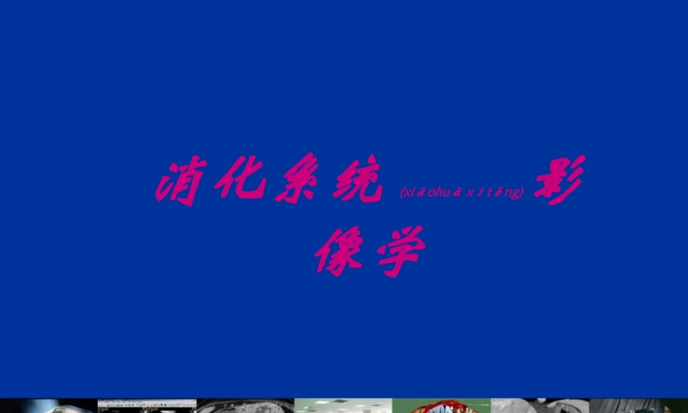 2022年医学专题—胃肠道CT检查.ppt