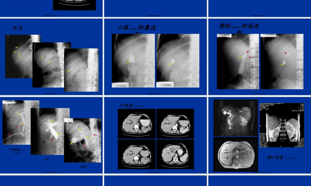 2022年医学专题—胃肠道CT检查.ppt