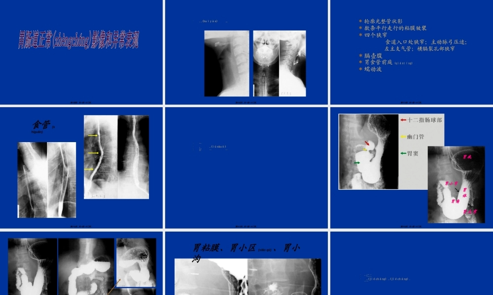 2022年医学专题—胃肠道CT检查.ppt