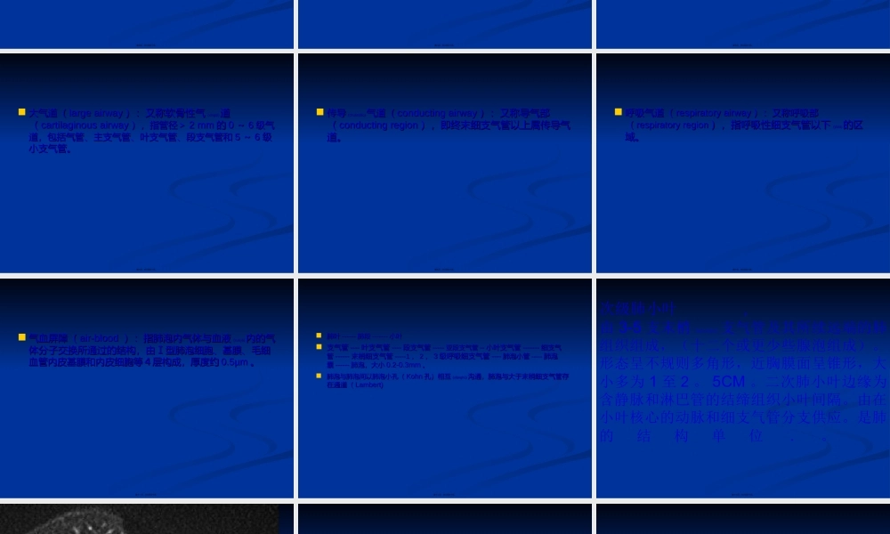 2022年医学专题—胸部CT影像征象高清图解.ppt
