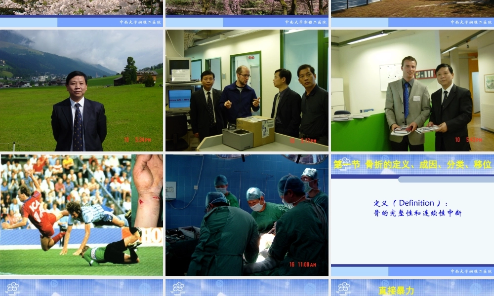 20骨科-骨折概论（修改）(1).ppt