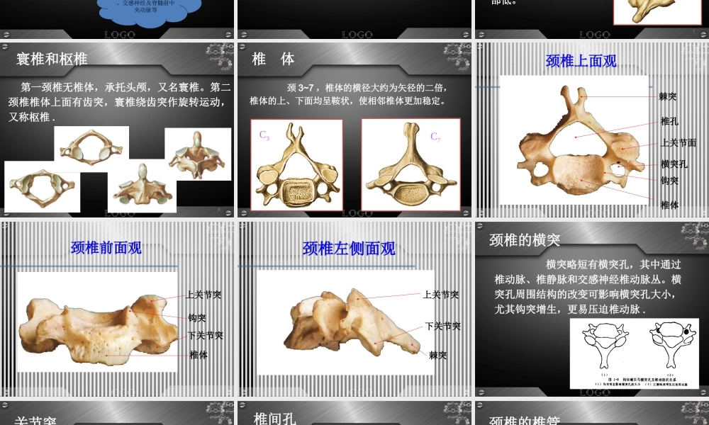 30骨科-颈椎病详解(1).ppt