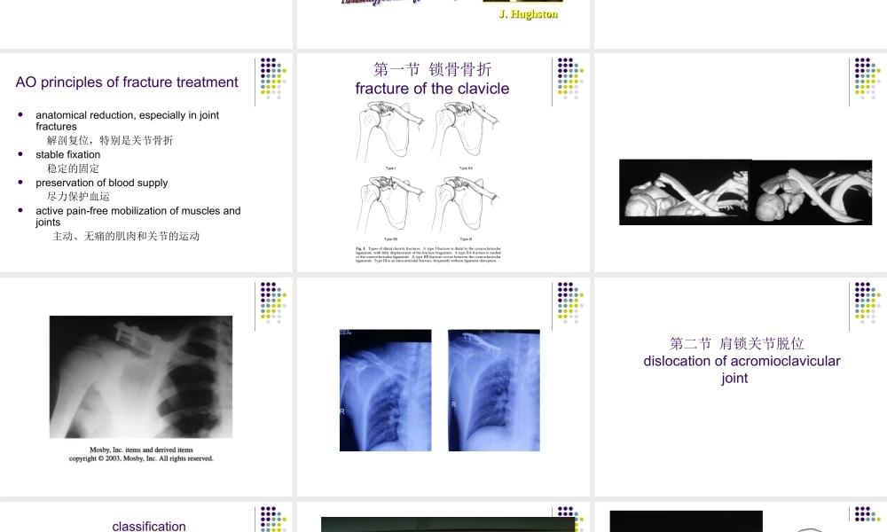 21骨科-骨折各论-shuangyu-new(1).ppt